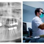 Endodoncia