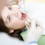 Ako prebieha implantácia v Smile Clinic.
