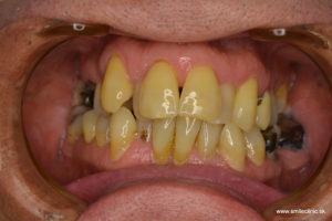 Pred ošetrením / Before treatment